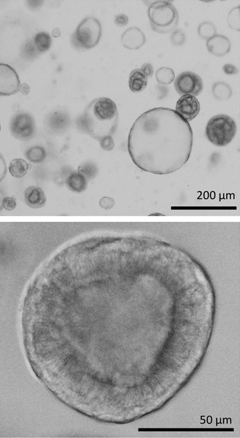 Human Lung Organoids Grown in Cultrex UltiMatrix RGF Basement Membrane Extract (BME).