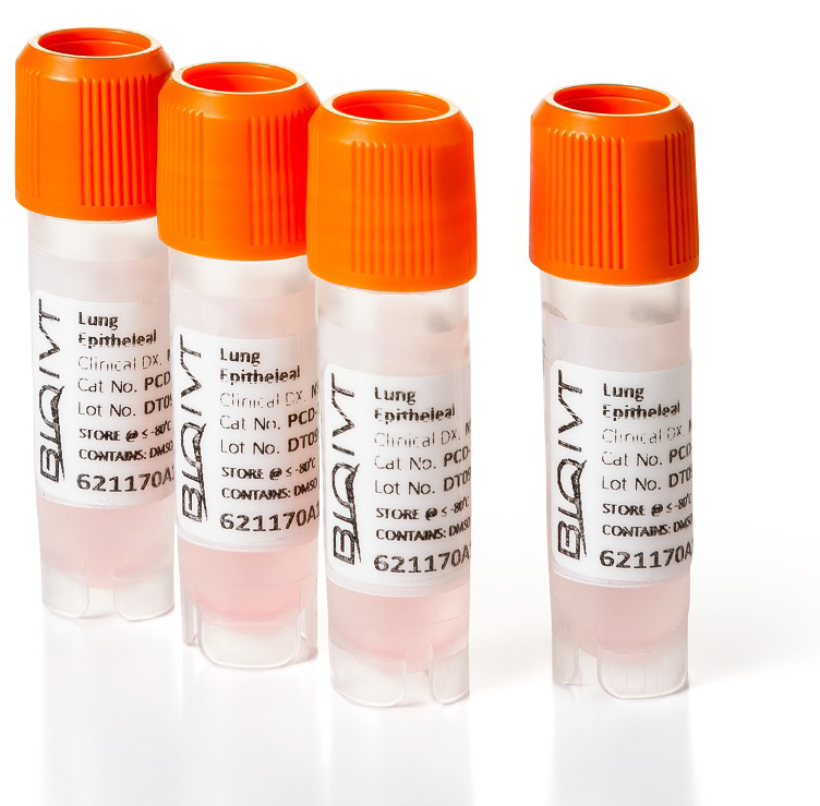 Extraction of tumor-infiltrating lymphocytes from disintegrated tumor cells