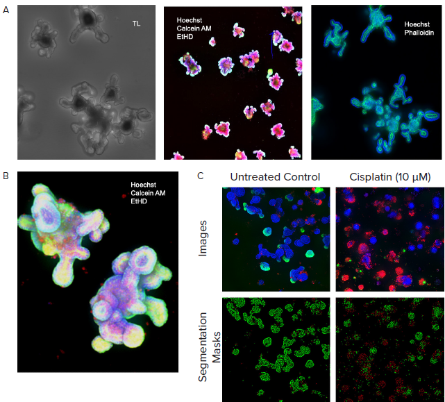 A. Monitored organoid development in transmitted light; live staining of organoids with viability dyes; fixed organoids stained with phalloidin. B. Organoids cultured for 10 days, stained with viability dyes. C. Control and treated organoids stained with viability dyes, live-dead analysis provided by MetaXpress analysis software.