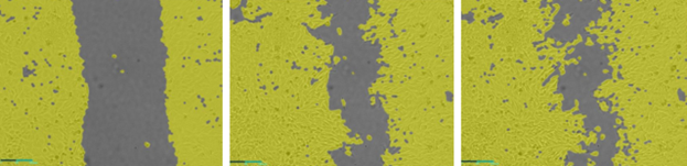 Wound healing image of HeLa cells