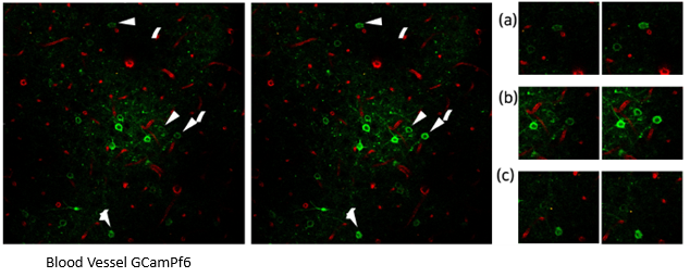 Visualization of GCaMP Expression