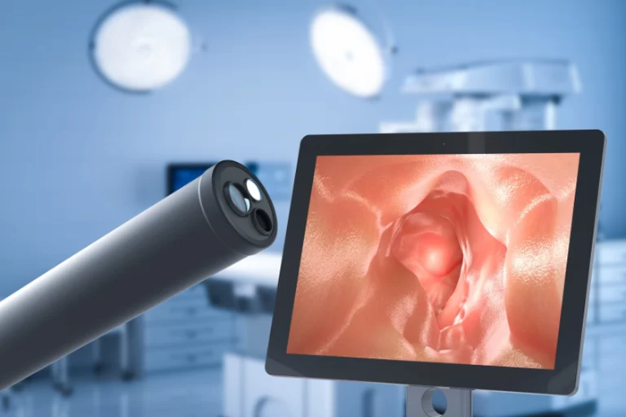 Chief ray angle (CRA): The hidden factor behind endoscopic technology