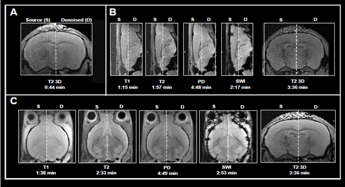 Examples of fast brain scans