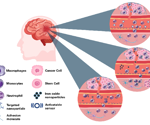 Preclinical MRI for neurological diseases with cellular and molecular imaging