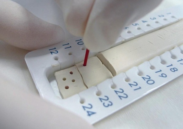 MVZ’s multi-target screening can now detect up to 81 substances in capillary blood samples.