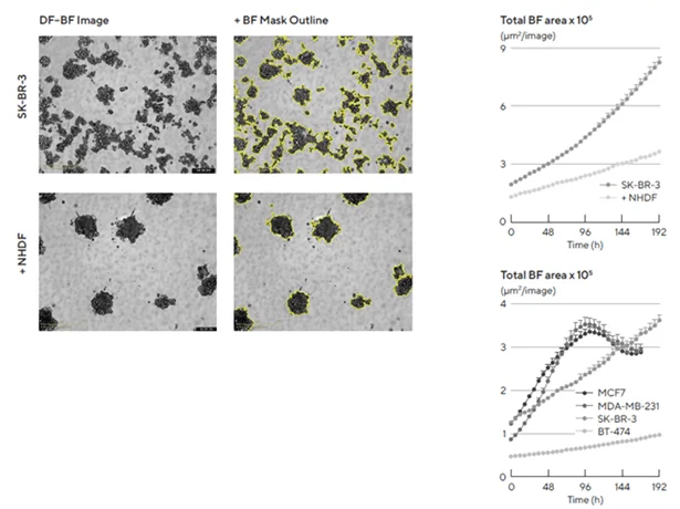 Morphology observations with Incucyte® DF-BF images and quantification of multi-spheroid size and kinetic growth using real-time analysis. SK-BR-3 cells were seeded in flat bottom, 96-well plates on a bed of Matrigel in mono- or co-culture with NHDFs (1:1 ratio, 1,000 cells/well for each) and multi-spheroids (MS) allowed to form (3 d). Incucyte® extended depth of focus Brightfield (DF Brightfield) images (8 d post cell seeding) of SK-BR-3 MS in mono- or co-culture with NHDFs. Brightfield outline mask shown in yellow. Note, the influence of NHDFs on SK-BR-3 MS morphology and size (Total Area). Time course plots show the individual well Total Brightfield Object Area (μm2) (y-axis) over time (h) (x-axis) and illustrate cell type specific kinetic growth profiles for a range of breast tumor MS co-cultured with NHDFs. Data were collected over 192 h period at 6 h intervals. Each data point represents mean ± SEM,