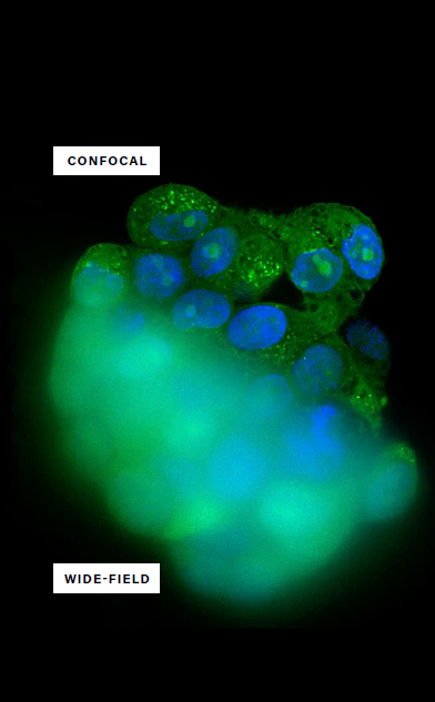 High-content analysis and its role in live-cell imaging