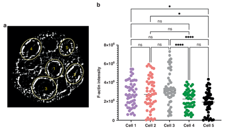 F-actin distribution (a) and quantification (b) in five colorectal cancer cells