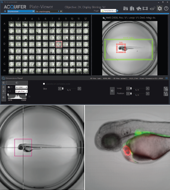 Illustration of Click-Tool functionality. Top: Three-day-old embryo of the epi:GFP;myl7mR transgenic line. Zebrafish embryos were visualized in Plate-Viewer software after the automated region of interest selection. Bottom left: The red bounding box indicates the field of view of a 10x objective used for subsequent high-resolution imaging. Bottom right: Single Z-plane of an automatically acquired high-resolution dataset