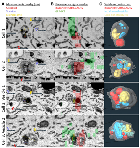Ultrastructural images of KSHV-containing vesicles and their three-dimensional reconstructions reveal amphisomal structures