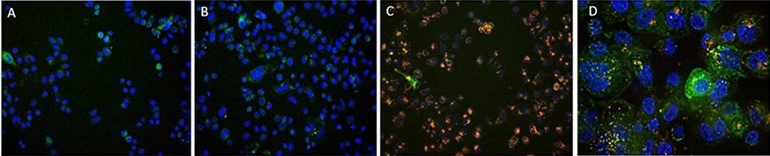 A. Antibody Internalization Detection Reagent (Cat.No. IGG-PZF2001). B. IgG1 Isotype+Internalization Detection Reagent conjugate. C. Anti-Her2 Abs+Internalization Detection Reagent conjugate. D. Anti-Her2 Abs+Internalization Detection Reagent conjugate(Z-stacking). (Green: CellLights Lysosome GFP, Blue: NucBlue Live ReadyProbes, Red: IGG-PZF2001,Cell line: SK-BR-3 Her2+).