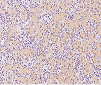 IFN-γ: A therapeutic target for cancer therapy