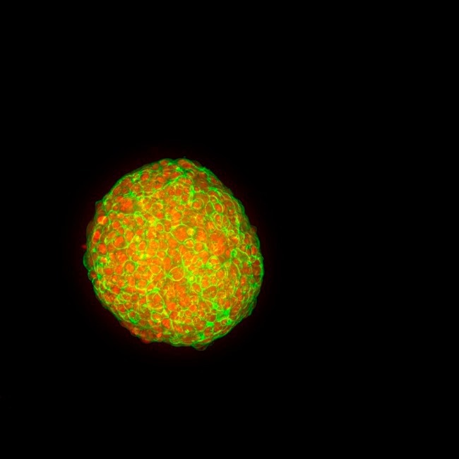 Scalable ImageXpress Confocal HT.ai High-Content Imaging System