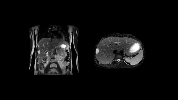 80 cm bore MAGNETOM Free.Max