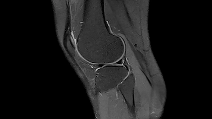 80 cm bore MAGNETOM Free.Max