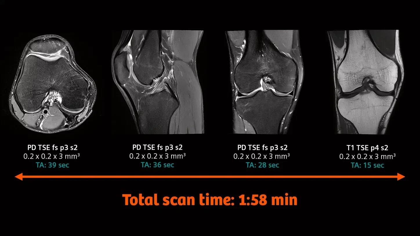 3T MRI scanner MAGNETOM Vida