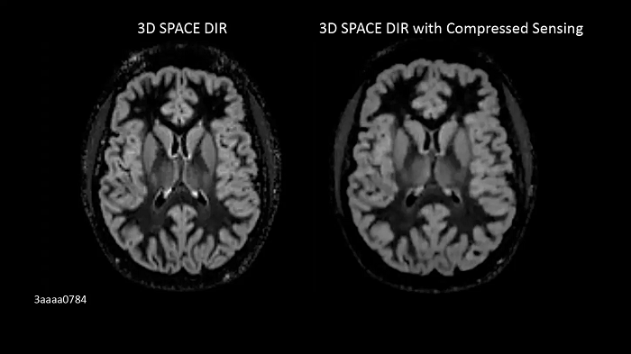 3T MRI scanner MAGNETOM Vida