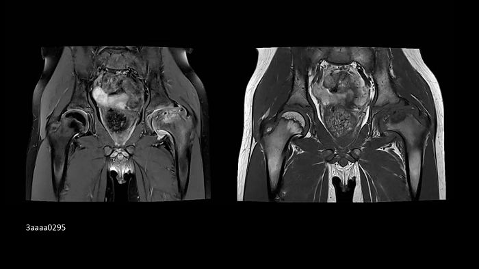 3T MRI scanner MAGNETOM Vida