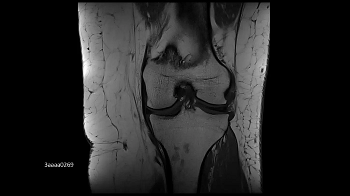 3T MRI scanner MAGNETOM Vida