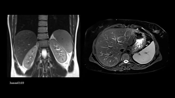 3T MRI scanner MAGNETOM Vida