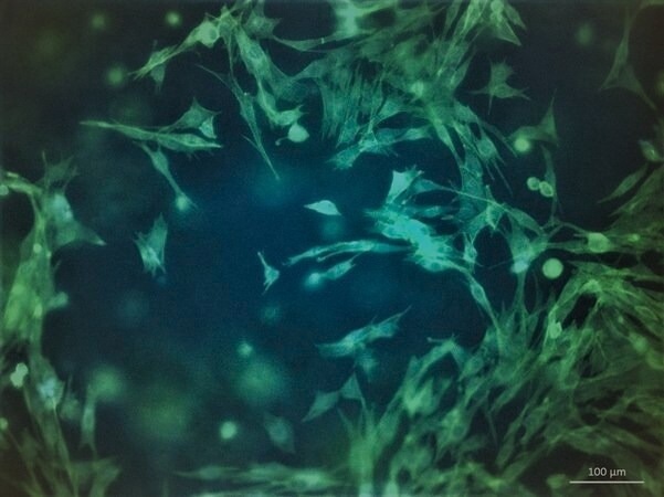 Morphology of C2C12 after 7 days post-printing with TissueFab® GelAlg UV. Cell cytoskeleton stained with F actin (green) and nuclei DAPI (blue).