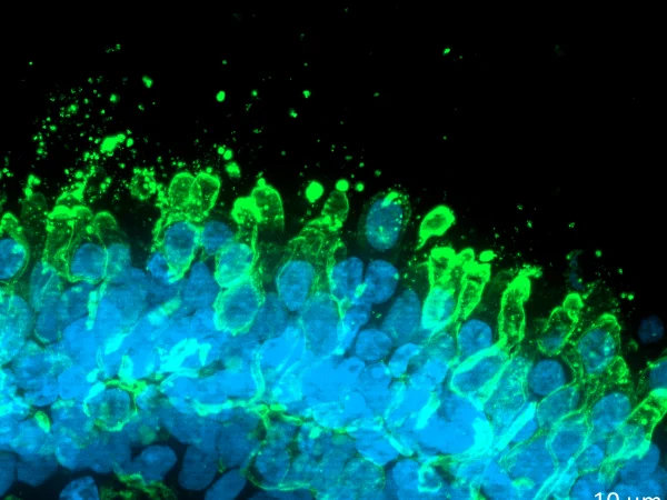 Retinal organoids at D180 of differentiation stained with Hoechst and Rhodopsin analyzed with Axio Observer with Apotome 3 system (Zeiss)