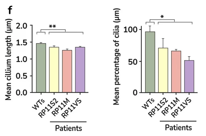 Quantification of cilia length and frequency in photoreceptors showing significant reduction in RP11 patients compared to the controls