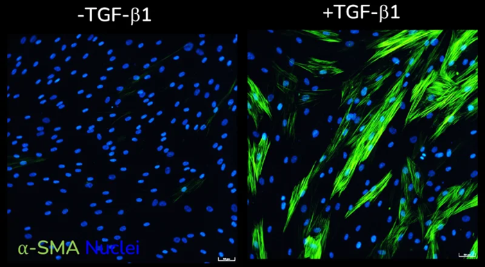 α-SMA expression without(left) and with(right) TGF-β1 stimulation of primary HLFs acquired using ImageXpress Confocal HT.ai imaging system, Scale bar: 50 µM