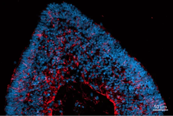 Localization and distribution of Müller glia cells (CRALBP, red) in retinal organoids. Nuclear DAPI staining (blue)