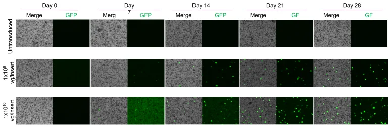 Dose- and time- dependent increase in GFP signal in AAV-transduced RPE. Percentage of GFP-positive cells over 28 days post transduction with AAV5-CAG-EGFP:WPR at two different doses. Scale: 150 µm.