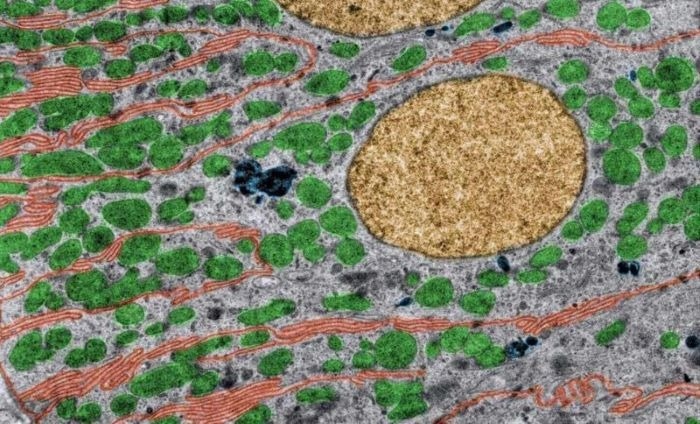 Kidney proximal tubules stained with Mallory