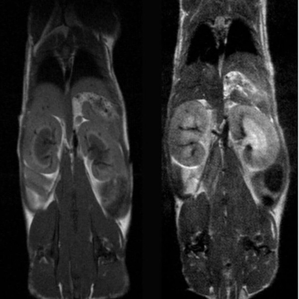 T1- and T2- weighted images of Wild-type mouse abdomen.