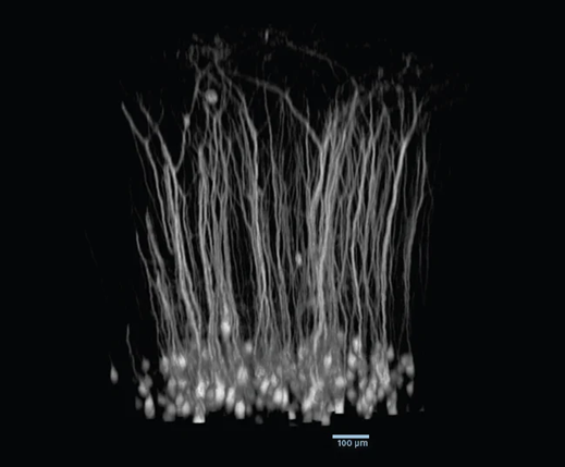 3D-view of volumetric stack recorded using the electrically tunable focusing module. Layer 5B neurons in mouse visual cortex in vivo, labelled with tdTomato. Scale bar 100 μm. Data courtesy of Lisa Bauer, Dustin Herrmann, Mehmet Fisek, Michael Häusser’s lab, UCL, London