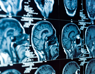How to choose the right labels for single particle tracking in super-resolution imaging