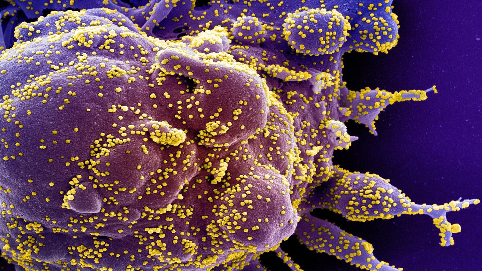 Study: Determining international spread of novel B.1.1.523 SARS-CoV-2 lineage. Image Credit: NIAID