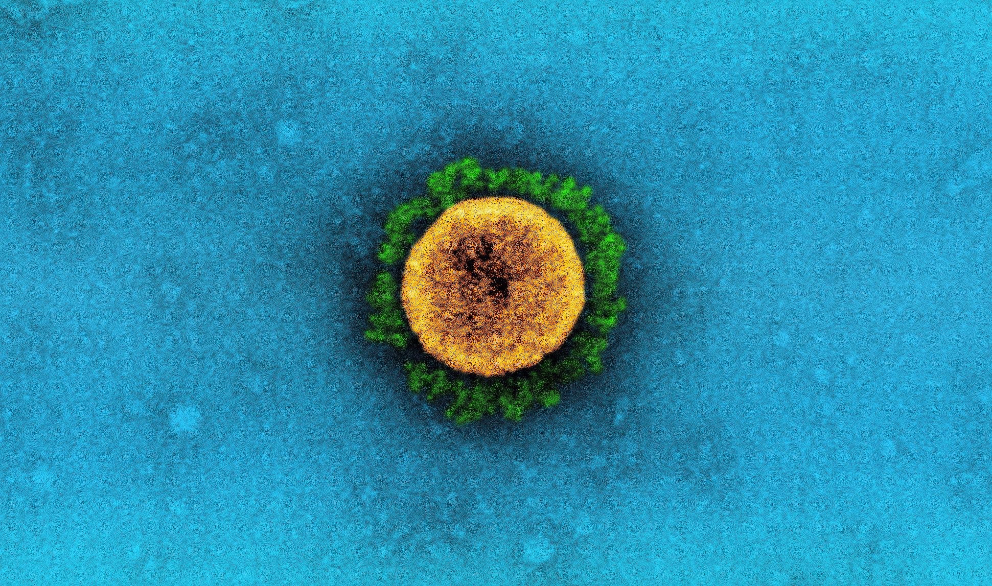 Study: Effectiveness of BNT162b2 and ChAdOx1 against SARS-CoV-2 household transmission: a prospective cohort study in England. Image Credit: NIAID