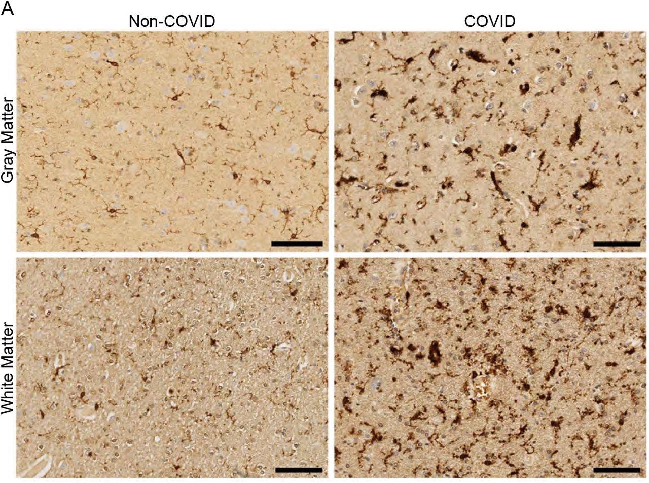 White matter-selective microglial reactivity in humans with SARS-CoV-2 infection (A) Representative micrographs of IBA1 immunostaining (brown) in the cerebral cortex (gray matter) or subcortical white matter of human subjects with or without COVID. Scale bars 100μm.