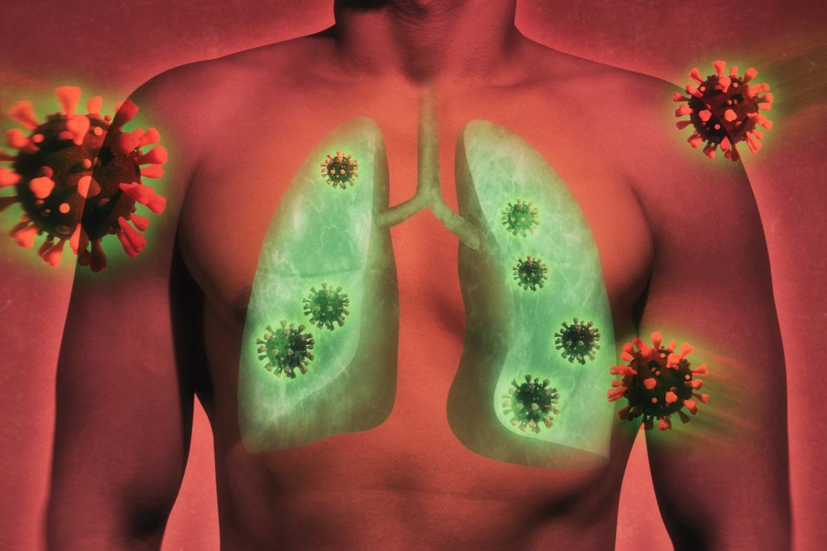 Study: The Investigation of Pulmonary Abnormalities using Hyperpolarised Xenon Magnetic Resonance Imaging in Patients with Long-COVID. Image Credit: SvetaZi/Shutterstock