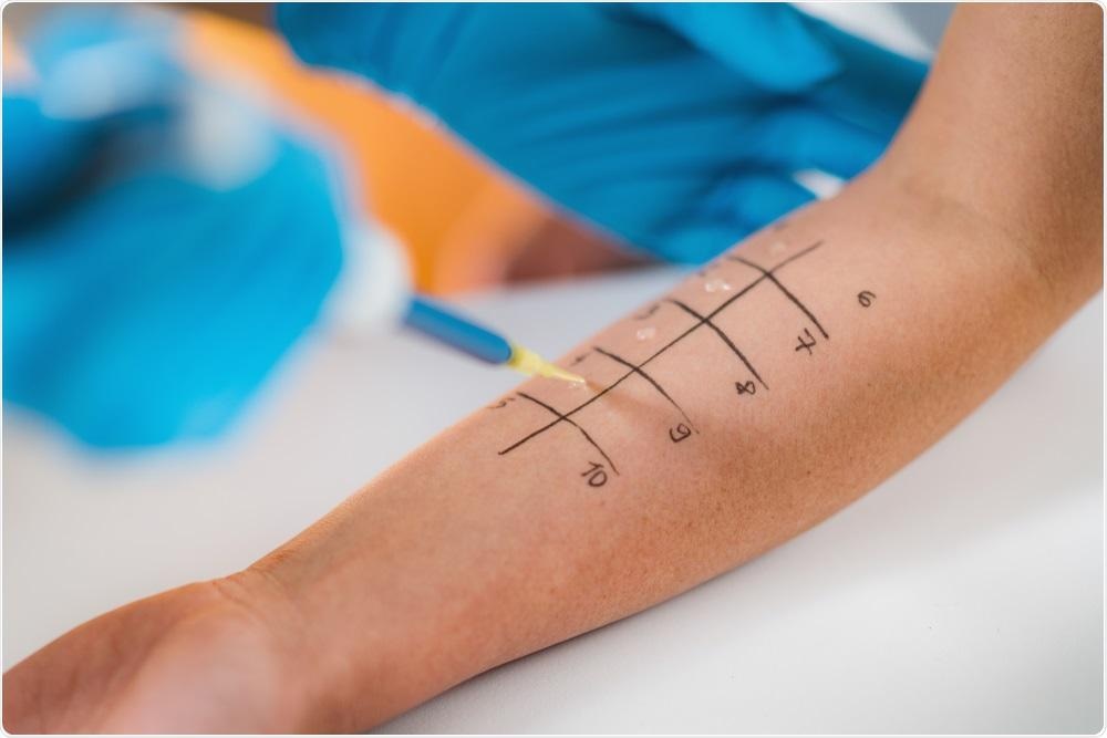 Study: Allergological Study in Patients Vaccinated Against COVID-19 with Suspected Allergic Reactions. Image Credit: Microgen / Shutterstock.com