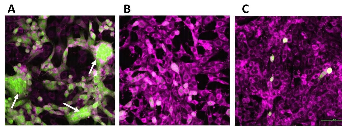 The oligonucleotides prevent MHV-A59-eGFP induced infection in fluorescently tagged secondary 17CL-1 cells (magenta colored). After 24h infection of primary cells, magenta-colored secondary cells were added and imaged after 24h for infection of secondary cells. Image represents primary infection with virus at 0.1 MOI for 1h adsorption. A. MHV-A59-eGFP with polymer1. B. MHV-A59-eGFP with Polymer1 and oligonucleotide 1. C. MHV-A59-eGFP with polymer1 and oligonucleotide 2. Rounded, aggregated, fused, and granulated cells rapidly detaching from the monolayer are shown in panel A. Arrow in panel indicates infection-induced syncytium (Original magnification 10X). Scale bar 100 μm.