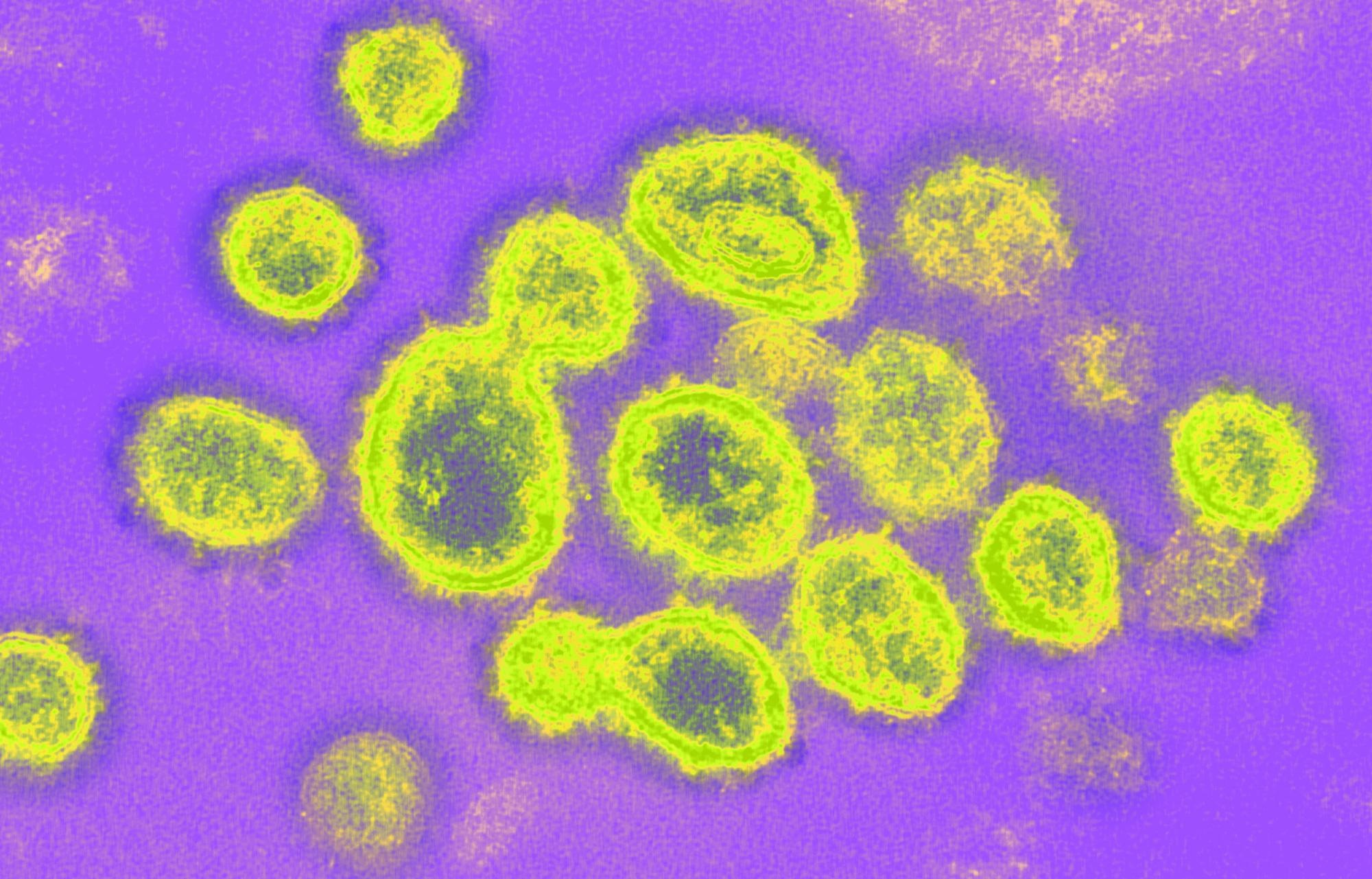 Study: Inferring selection effects in SARS-CoV-2 with Bayesian Viral Allele Selection. Image Credit: NIAID