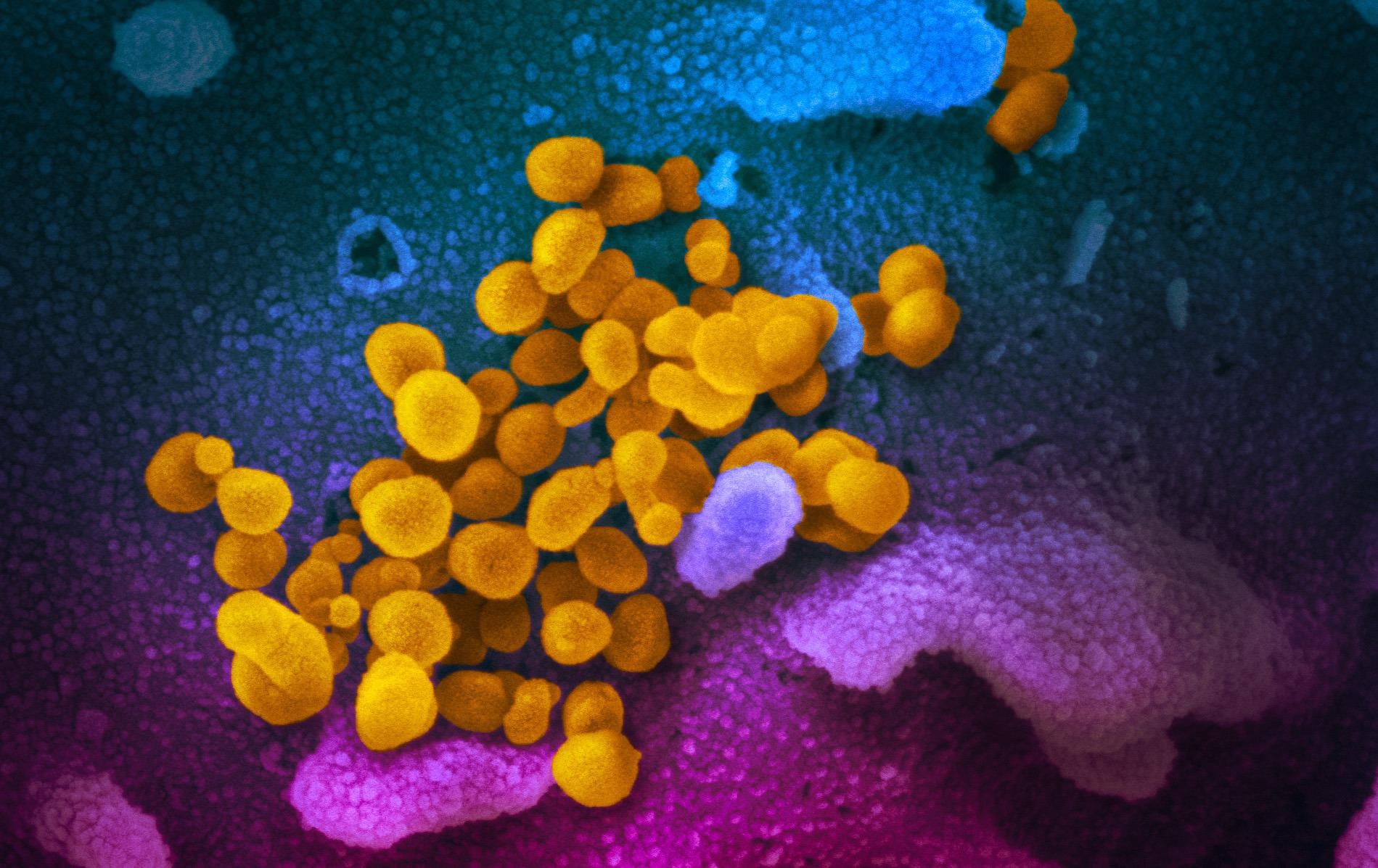 Study: Macromolecular Viral Entry Inhibitors as Broad-Spectrum First-Line Antivirals with Activity against SARS-CoV-2. Image Credit: NIAID