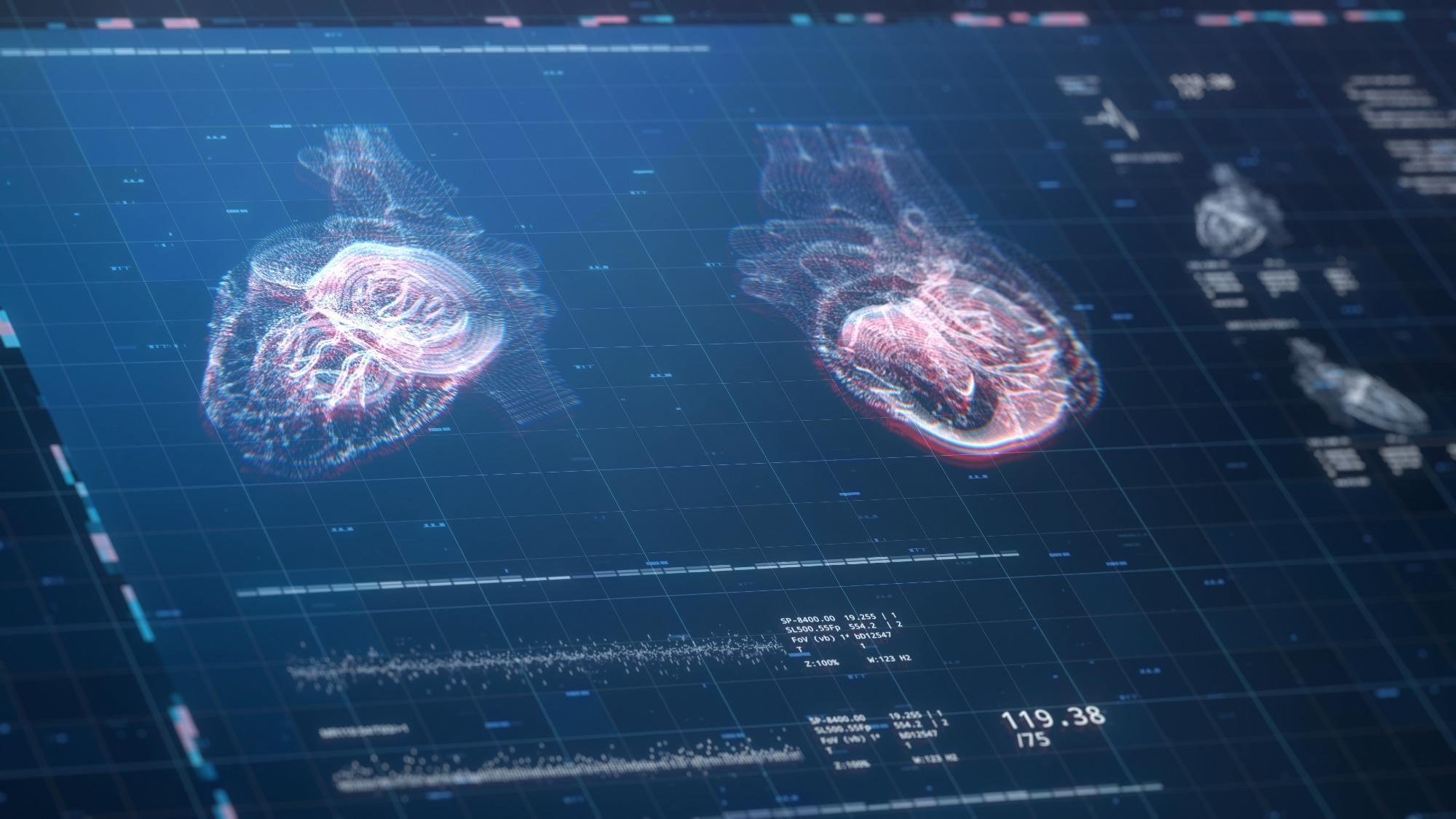 Study: Arrhythmic sudden death survival prediction using deep learning analysis of scarring in the heart. Image Credit: SquareMotion / Shutterstock