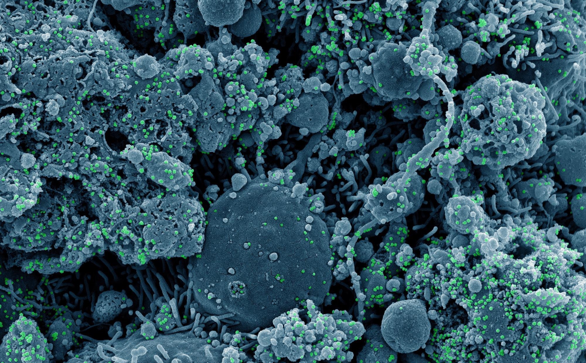 Study: Efficacy and safety of intramuscular administration of tixagevimab–cilgavimab for early outpatient treatment of COVID-19 (TACKLE): a phase 3, randomised, double-blind, placebo-controlled trial. Image Credit: NIAID