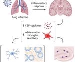 Even mild respiratory COVID can affect the brain