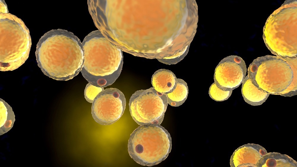 Study: Obesity-Mediated Immune Modulation: One Step Forward, (Th)2 Steps Back. Image Credit: Spectral Design / Shutterstock.com