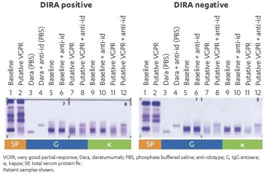 How to assess clinical response in multiple myeloma