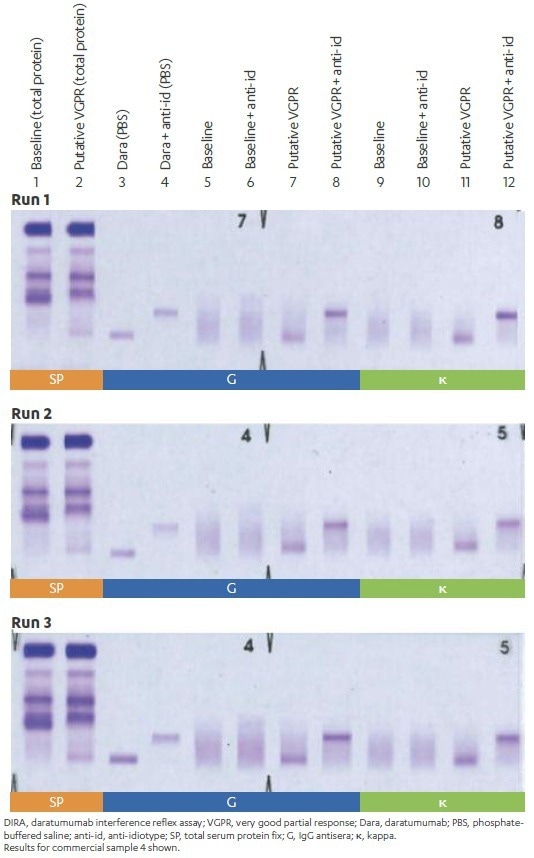 How to assess clinical response in multiple myeloma