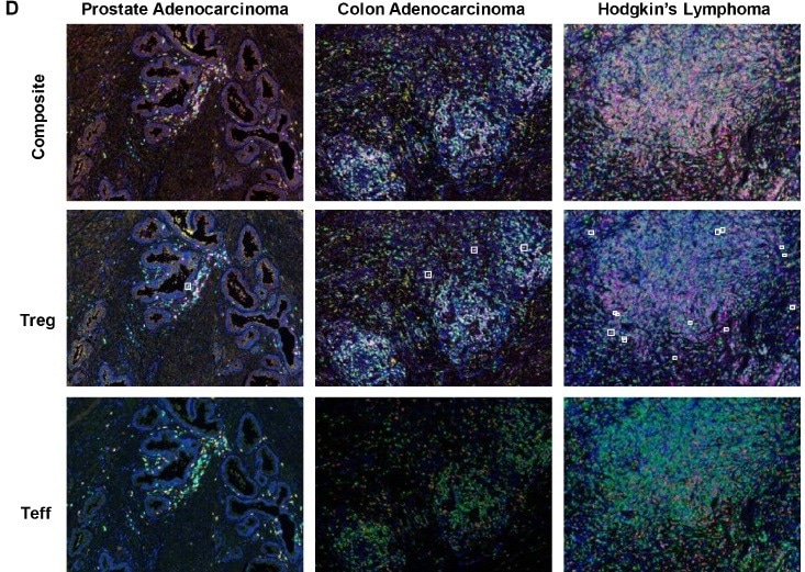 Detecting tissue-resident memory T cells in solid tumors