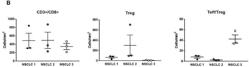Detecting tissue-resident memory T cells in solid tumors